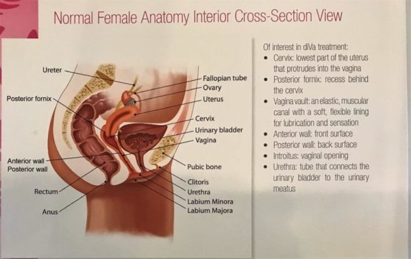 Gynecology cross section Camarillo