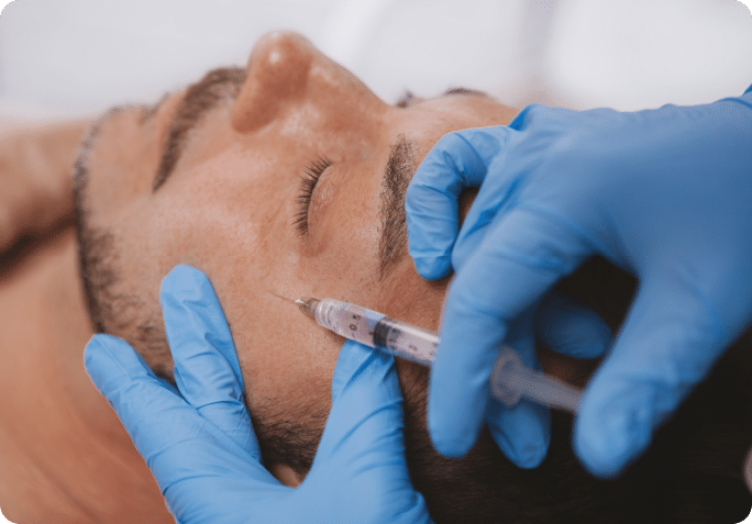 Dermal Fillers